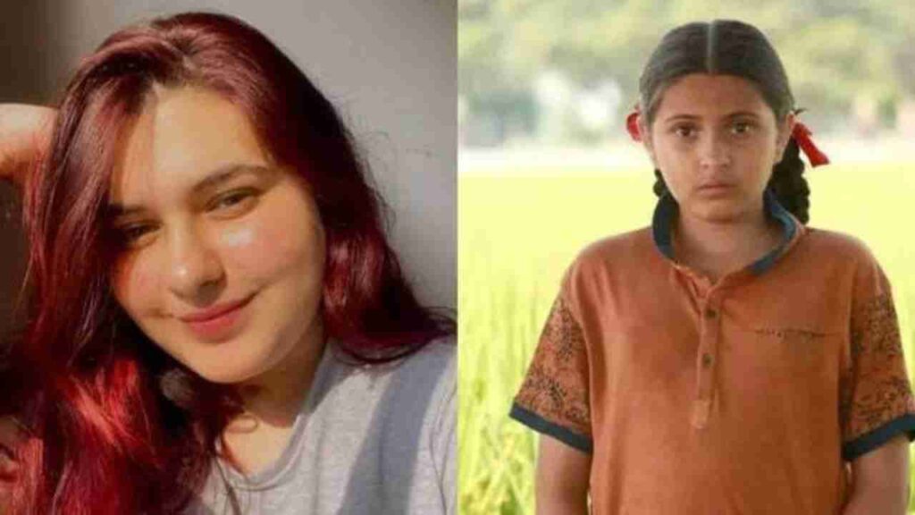 Dangal Star's Tragic Battle: Unraveling Dermatomyositis - Causes, Symptoms, and Treatment